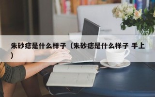 朱砂痣是什么样子（朱砂痣是什么样子 手上）