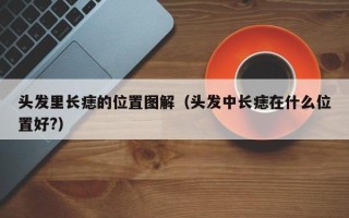 头发里长痣的位置图解（头发中长痣在什么位置好?）